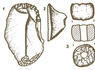 Sokillete. Ajuar (J. Apellán, Corpus)